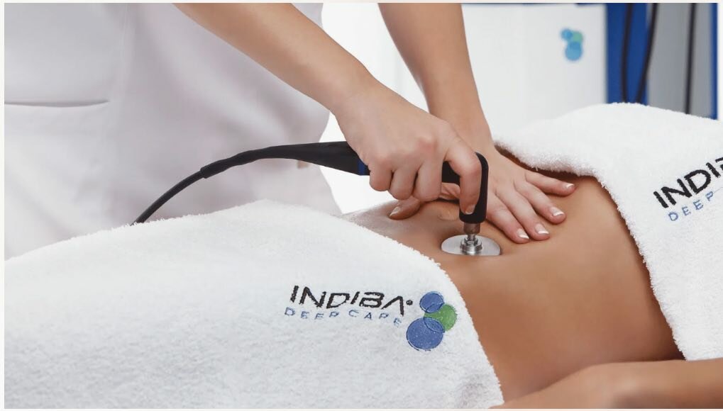 технология Indiba